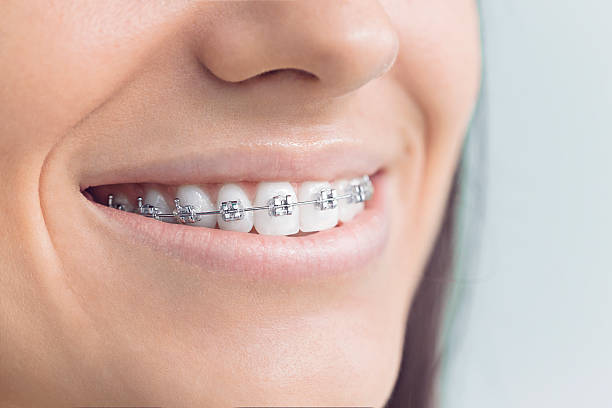 TMJ/TMD Treatment in Elma Center, NY
